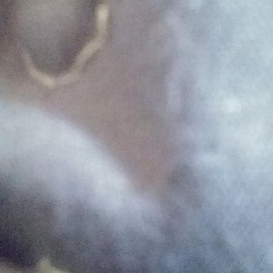 Meet your Posher, Allen